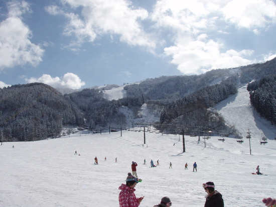 20年間通ってます！|立山山麓スキー場のクチコミ画像