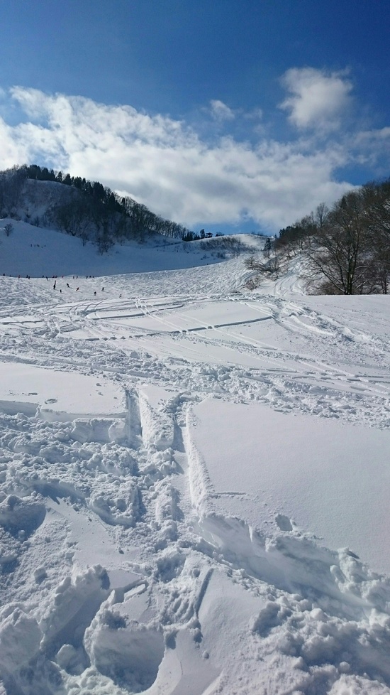 ゴンドラで一気に上へ！滑った後はまったり温泉♪|おじろスキー場のクチコミ画像